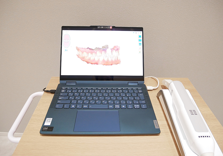 口腔内3Dスキャナー