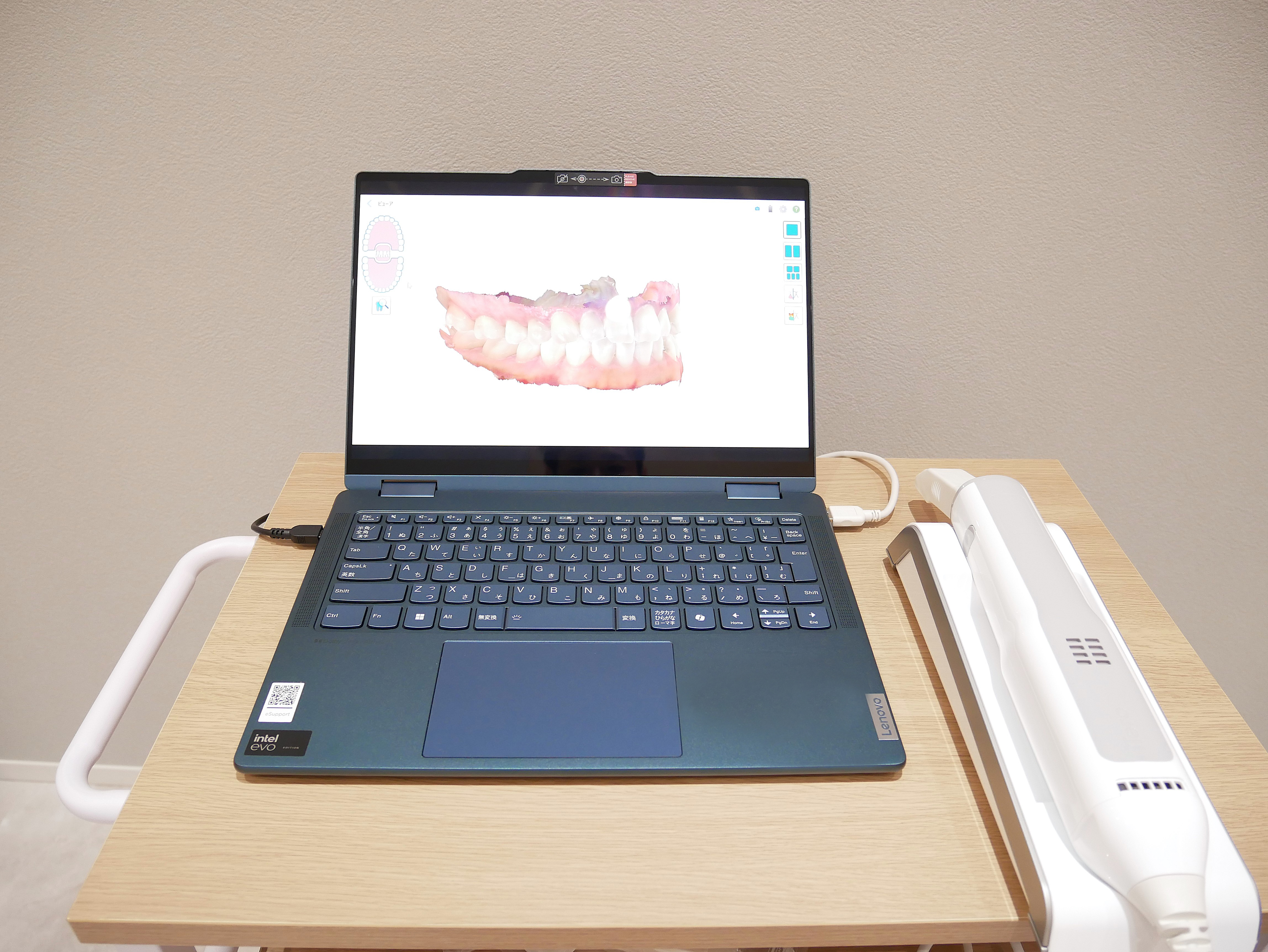 精密検査・口腔内スキャン