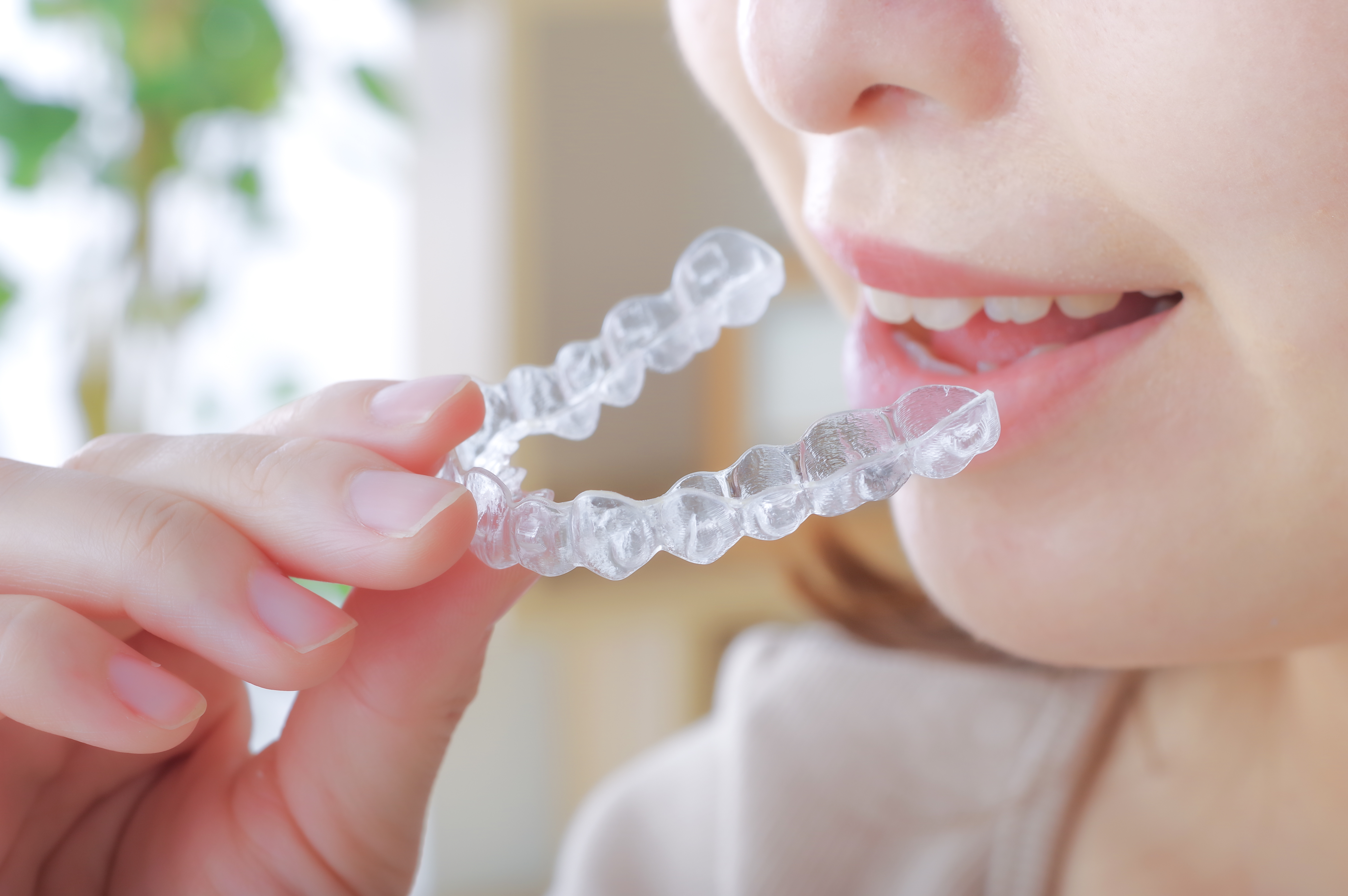 マウスピース作製・装着開始