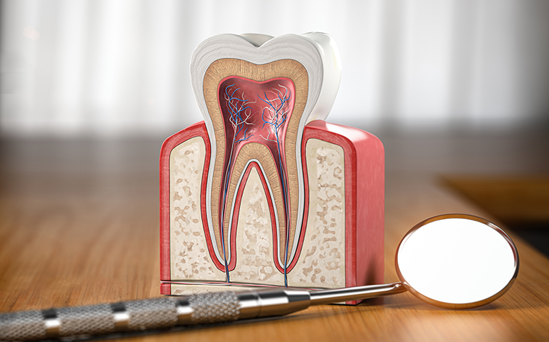 根管治療（歯内療法）